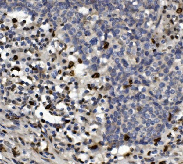 a00592 4 samhd1 primary antibodies ihc testing 3