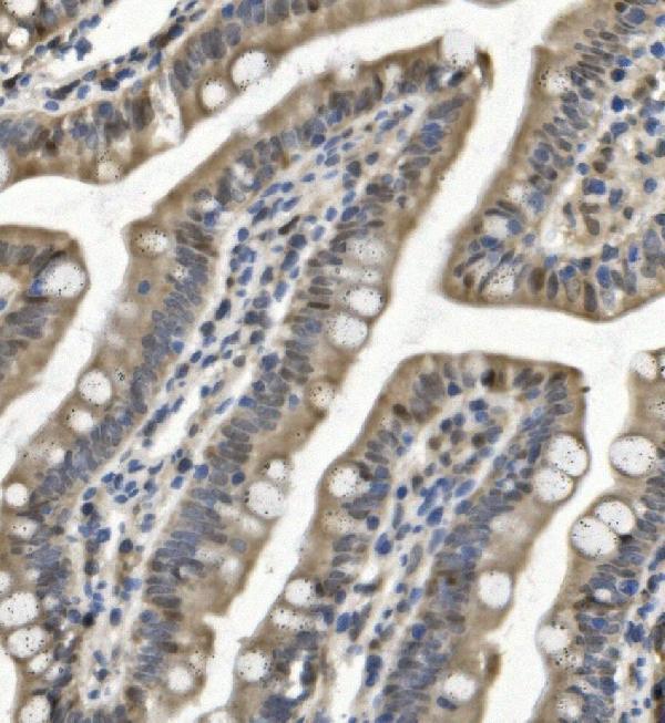 a00592 4 samhd1 primary antibodies ihc testing 6