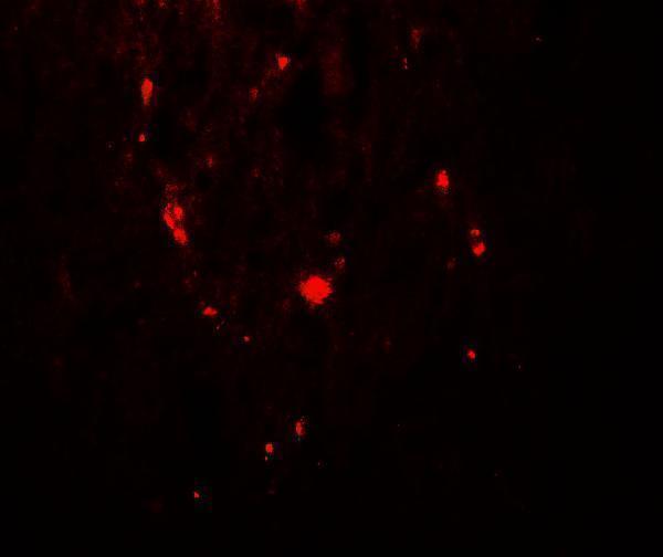 a00592t592 samhd1 primary antibodies if testing 4