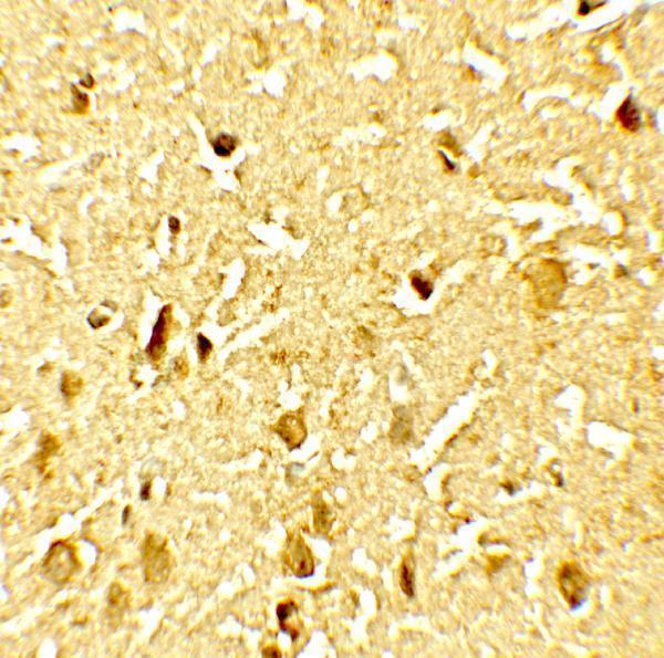 a00592t592 samhd1 primary antibodies ihc testing 3