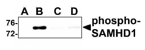a00592t592 samhd1 primary antibodies wb testing 1