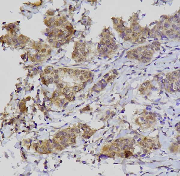 a00593 1 gata3 primary antibodies ihc testing 2