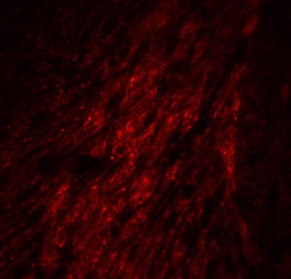 a00593 gata3 primary antibodies if testing 5