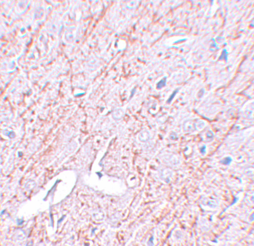 Immunohistochemistry of GATA3 in rat brain tissue with GATA3 antibody at 2