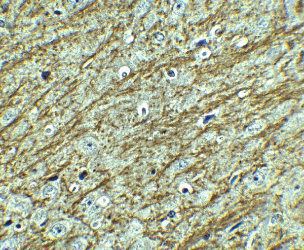 a00593 gata3 primary antibodies ihc testing 4