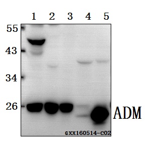 Western blot (WB) analysis of ADM polyclonal antibody at 1:500 dilution
Lane1:HCT116 whole cell lysate(40ug)
Lane2:A549 whole cell lysate(40ug)
Lane3:HEK293T whole cell lysate(40ug)
Lane4:The Kidney lysate of Rat(40ug)
Lane5:The Kidney lysate of Mouse (40ug)