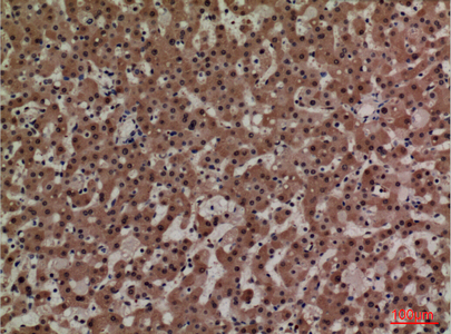 a00594 adm primary antibodies ihc testing 4