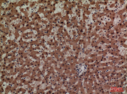 a00594 adm primary antibodies ihc testing 5