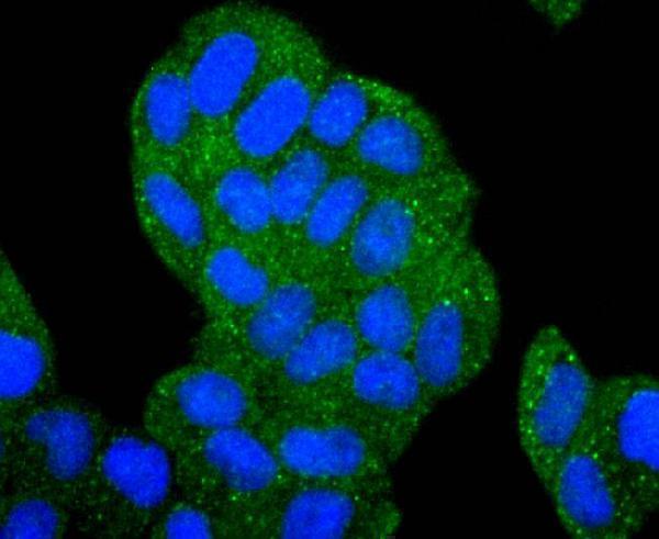 ICC staining HDAC6 in Hela cells (green)