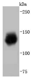 Western blot analysis of HDAC6 on Jurkat cells lysates using anti-HDAC6 antibody at 1/1,000 dilution