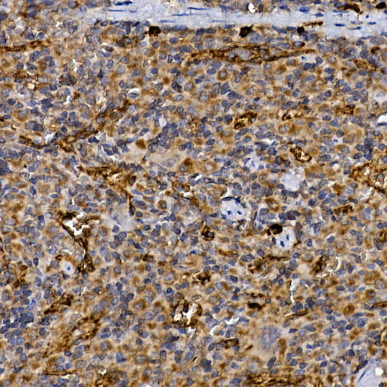 Immunohistochemistry of paraffin-embedded rat spleen using CD26/DPP4 Rabbit pAb  at dilution of 1:25 