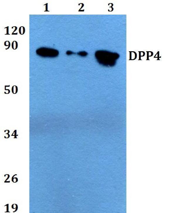 Western blot (WB) analysis of DPP4 polyclonal antibody at 1:500 dilution
Lane1:HEK293T whole cell lysate
Lane2:sp2/0 whole cell lysate 
Lane3:PC12 whole cell lysate 