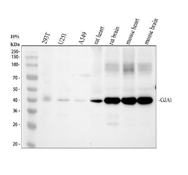 Western blot analysis of GJA1 using anti-GJA1 antibody (A00599)