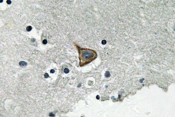 a00599s367 gja1 primary antiboties ihc testing 2