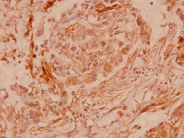 a00599s369 gja1 primary antiboties ihc testing 2