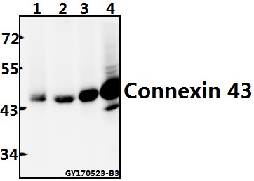 a00599s369 gja1 primary antiboties wb testing 1
