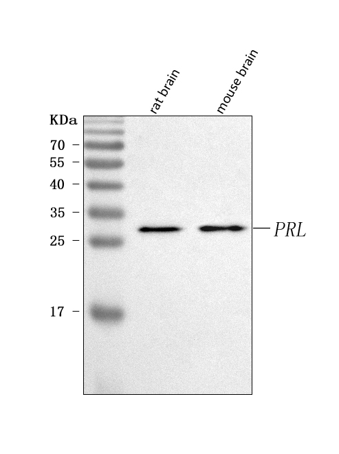  Western blot analysis of Prolactin/PRL using anti-Prolactin/PRL antibody (A00601-1)