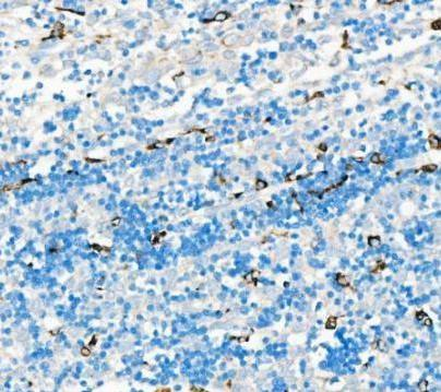 a00602 1 cd68 primary antibodies ihc testing 2_1