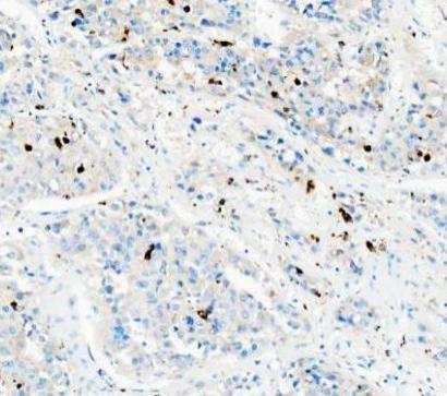 a00602 1 cd68 primary antibodies ihc testing 3_1