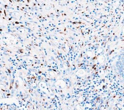 a00602 1 cd68 primary antibodies ihc testing 4_1