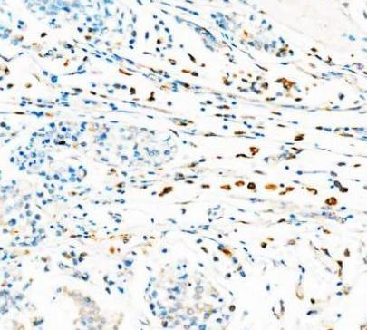 a00602 1 cd68 primary antibodies ihc testing 5_1