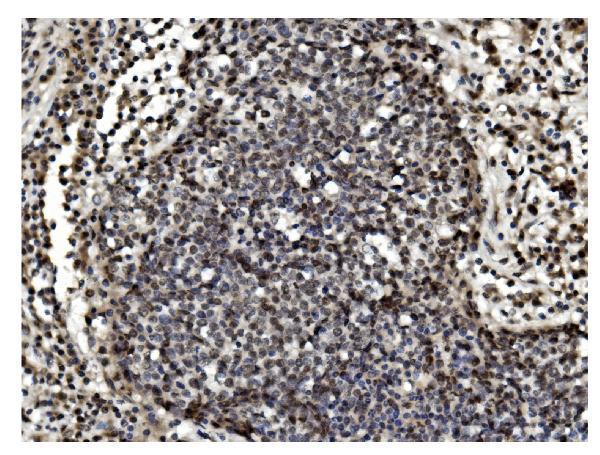  IHC analysis of TET1 using anti TET1 antibody (A00603-2)