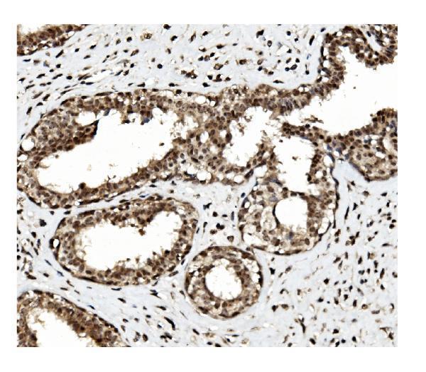  IHC analysis of TET1 using anti TET1 antibody (A00603-2)