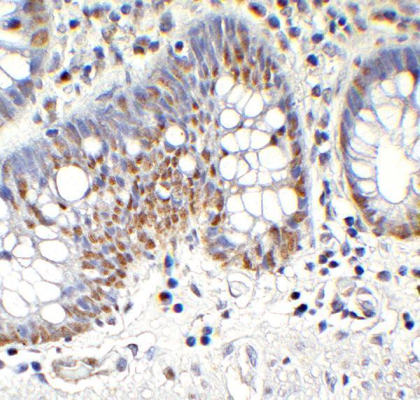 a00603 tet1 primary antibodies ihc testing 6