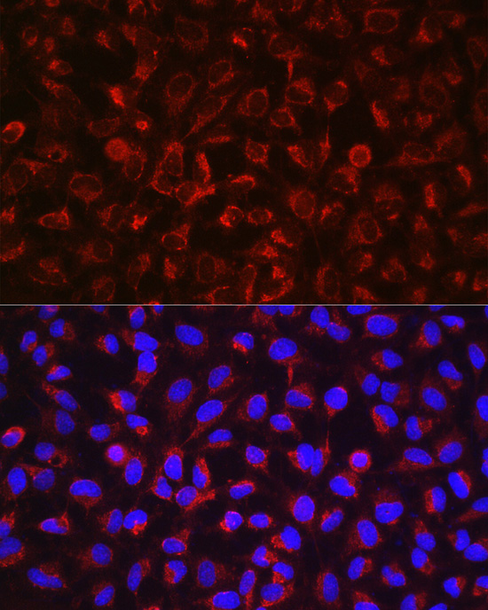 a00604 2 adam17 primary antiboties if testing 3