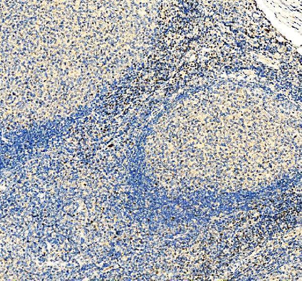 a00605 2 lef1 primary antibodies ihc testing 1