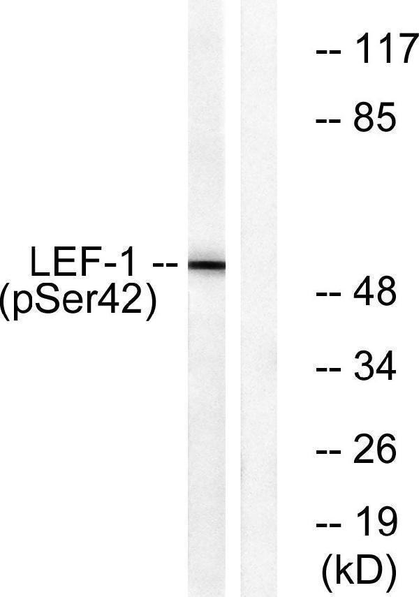 Western blot analysis of lysates from 293 cells treated with paclitaxel 1uM 24h, using LEF-1 (Phospho-Ser42) Antibody