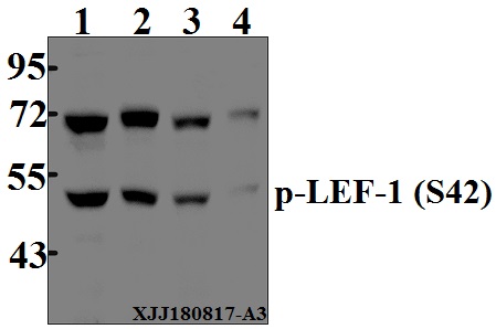 Western blot (WB) analysis of p-LEF-1 (S42) pAb at 1:500 dilution
Lane1:HCT116 whole cell lysate(40µg)
Lane2:LOVO whole cell lysate(40µg)
Lane3:DLD whole cell lysate(40µg)
Lane4:The Thymus lysate of Rat(40µg)
