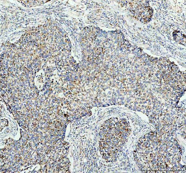  IHC analysis of GAS6 using anti-GAS6 antibody (A00608-1)