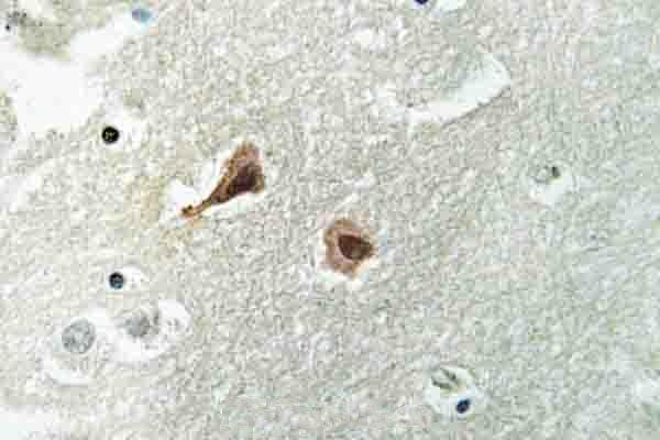 Immunohistochemistry (IHC) analyzes of VCP (A346) pAb in paraffin-embedded human brain tissue