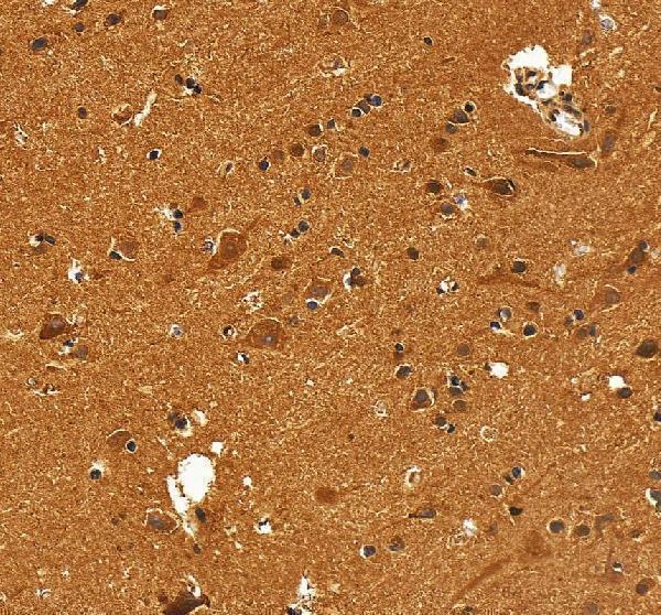 IHC analysis of VCP using anti-VCP antibody (A00610-2)