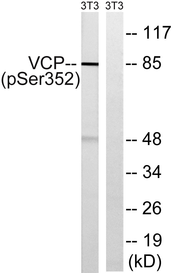 Western blot analysis of lysates from NIH/3T3 cells treated with starved 24h, using VCP (Phospho-Ser352) Antibody
