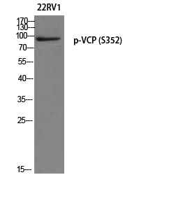 Western blot analysis of 22RV1 using p-VCP (S352) antibody