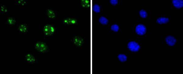 a00611 1 sirt6 primary antiboties icc testing 2