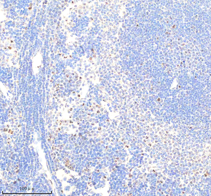 IHC analysis of SIRT6 using anti-SIRT6 antibody (A00611-2)