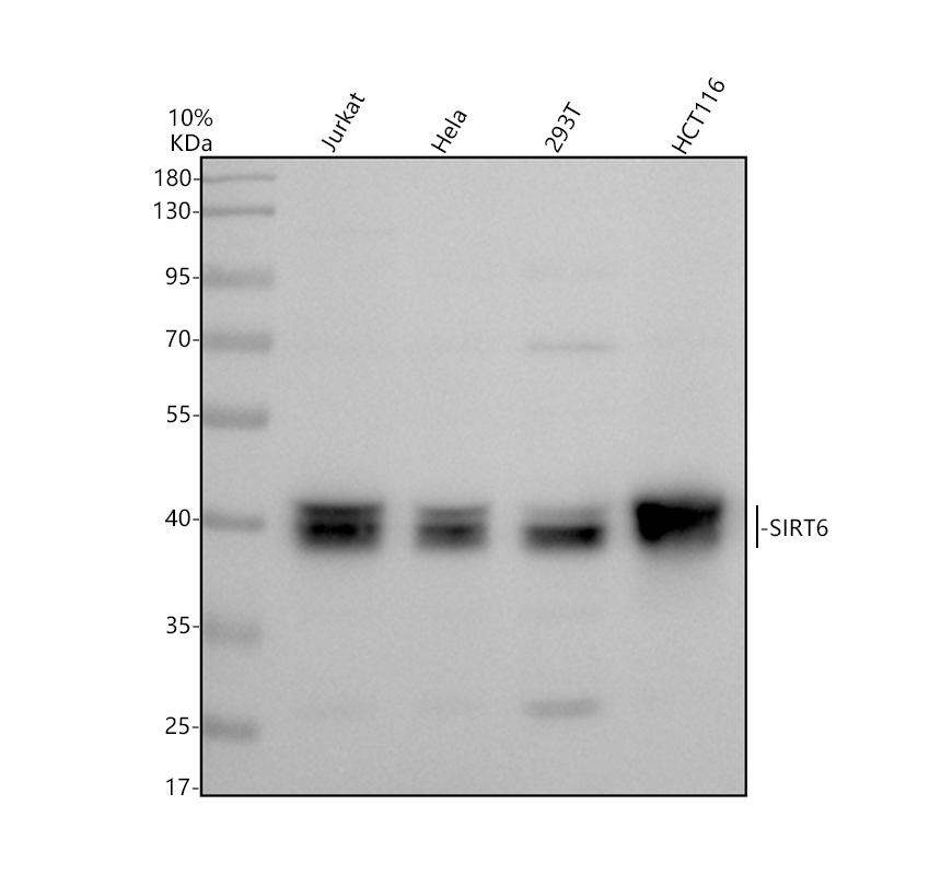 Western blot analysis of SIRT6 using anti-SIRT6 antibody (A00611-2)