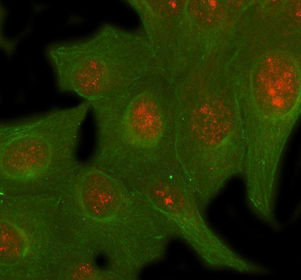 a00611 3 sirt6 primary antibodies if testing 2