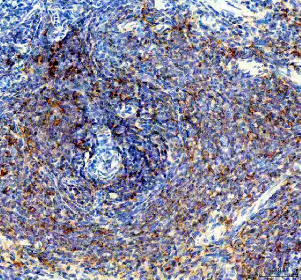 a00613 1 ptp1b primary antibodies ihc testing 2_1