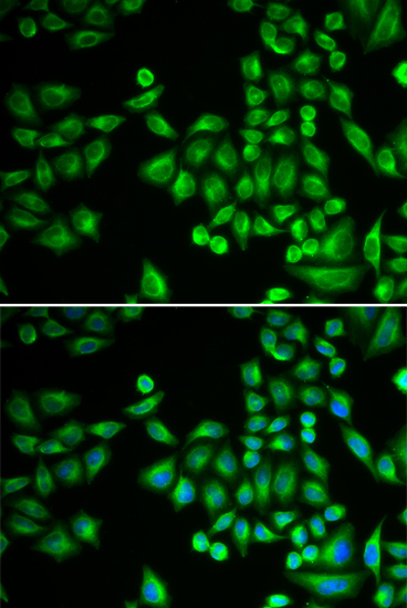 a00613 2 ptpn1 primary antiboties if testing 2