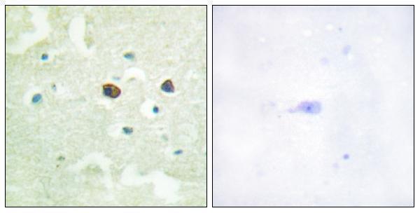 a00613s50 ptpn1 primary antibodies ihc testing 3