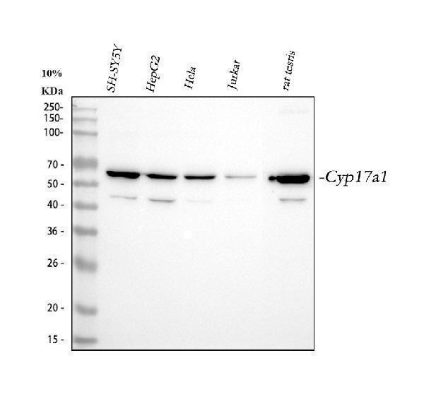  Western blot analysis of CYP17A1 using anti-CYP17A1 antibody (A00615-1)