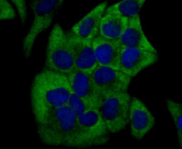 a00615 2 cyp17a1 primary antiboties icc testing 1
