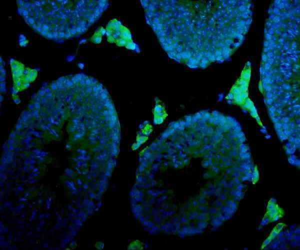 a00615 3 cyp17a1 primary antibodies if testing 4