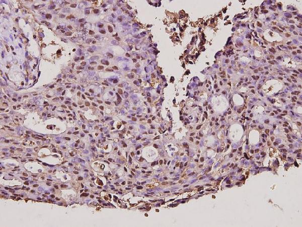 a00615 cyp17a1 primary antiboties ihc testing 2