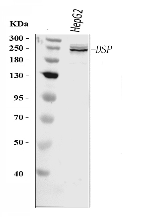  Western blot analysis of Desmoplakin/DSP using anti-Desmoplakin/DSP antibody (A00616-2)