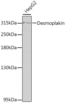 a00616 dsp primary antiboties wb testing 1